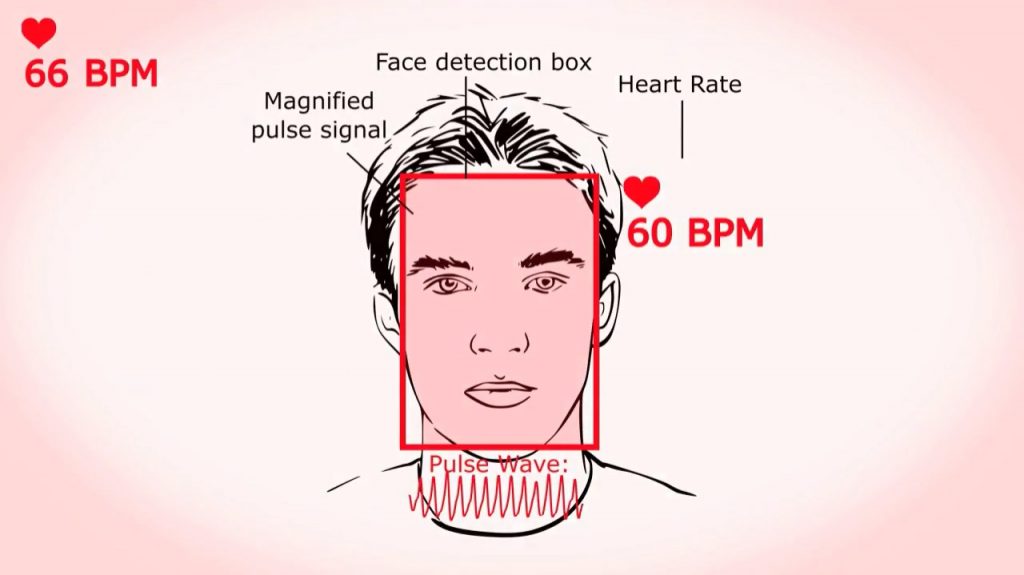 Cardiolens. 