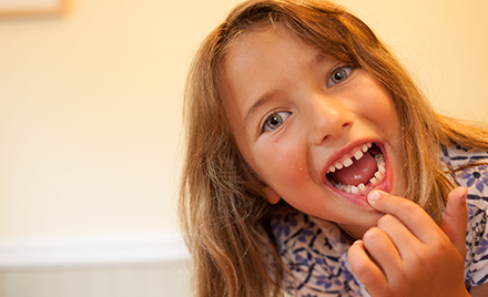 Image of a girl pointing to a missing tooth and smiling